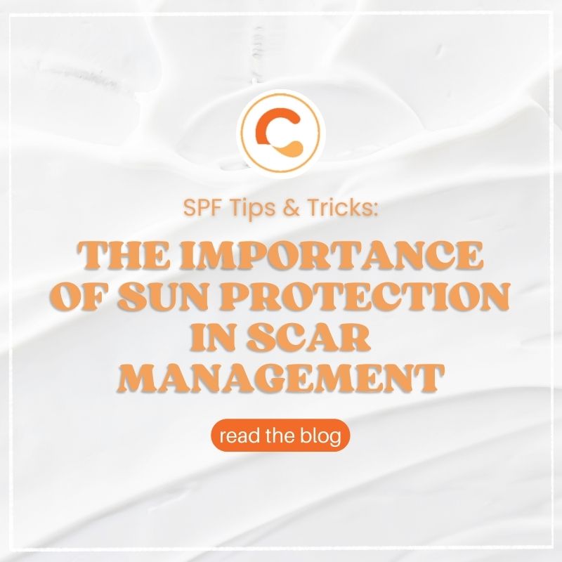 The Importance of Sun Protection in Scar Management: 4 SPF Tips and Recommendations