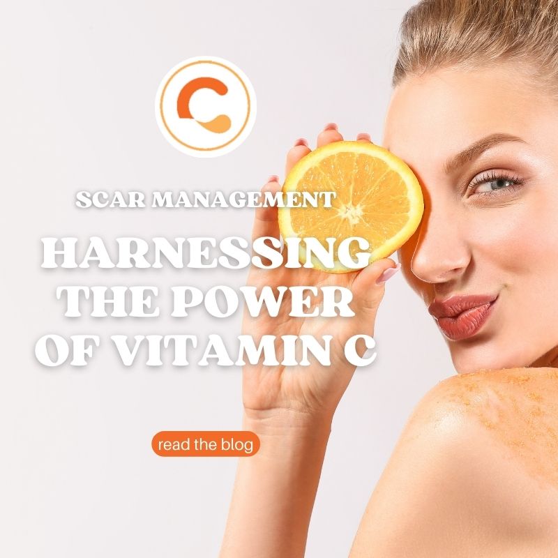 Harnessing the Power of Vitamin C for Scar Management