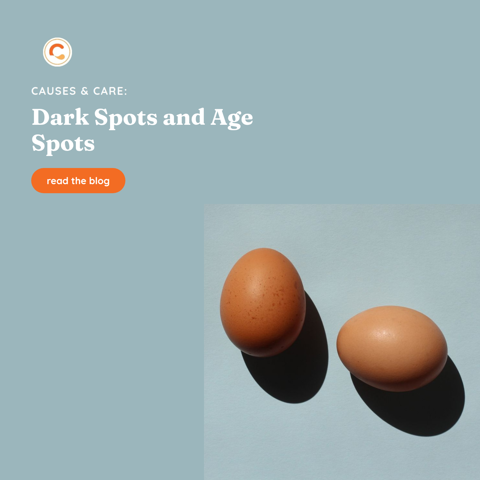 InviCible-branded graphic featuring two brown eggs with age spots, alongside the headline Dark Spots and Age Spots, InviCible logo, and read the blog button