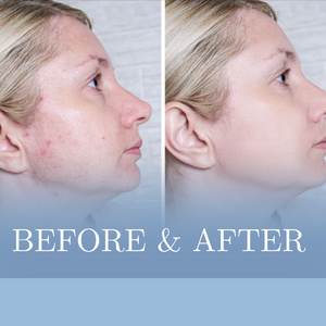 InviCible Primer+™ & Dark Spot Corrector